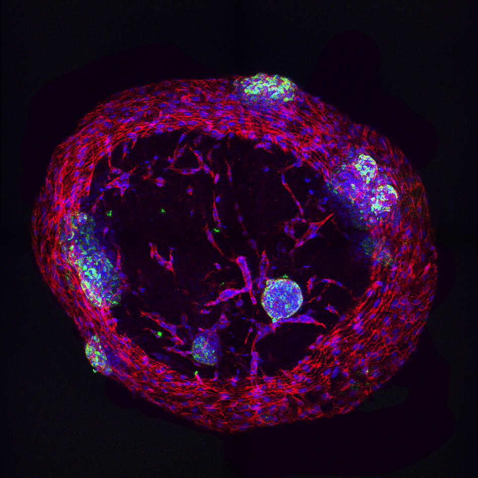 A magnified scientific picture of a round, blue-red shape with green spots. 