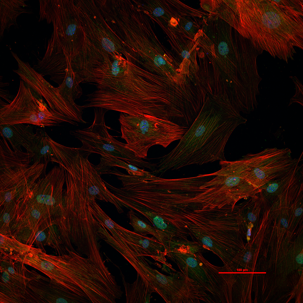 A magnified scientific picture of red cellular webbing with green-blue spots.
